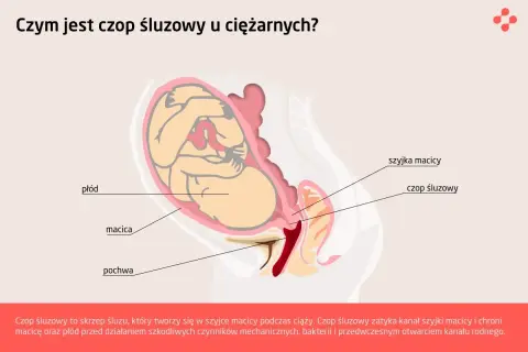 Schemat przedstawia płód w macicy. Widoczny jest czop śluzowy zamykający szyjkę macicy, chroniący przed porodem.