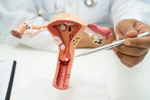 Model anatomiczny narządów rodnych kobiety, z zaznaczoną otwartą szyjką macicy w ciąży. Lekarz wskazuje na model.