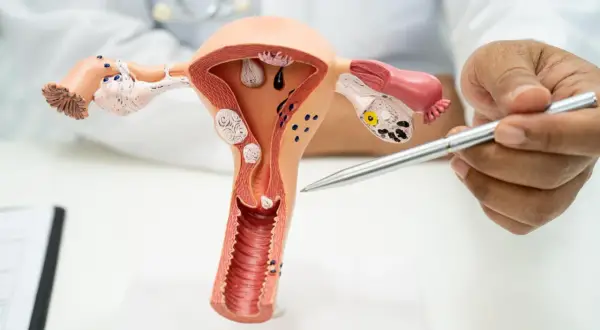 Model anatomiczny narządów rodnych kobiety, z zaznaczoną otwartą szyjką macicy w ciąży. Lekarz wskazuje na model.