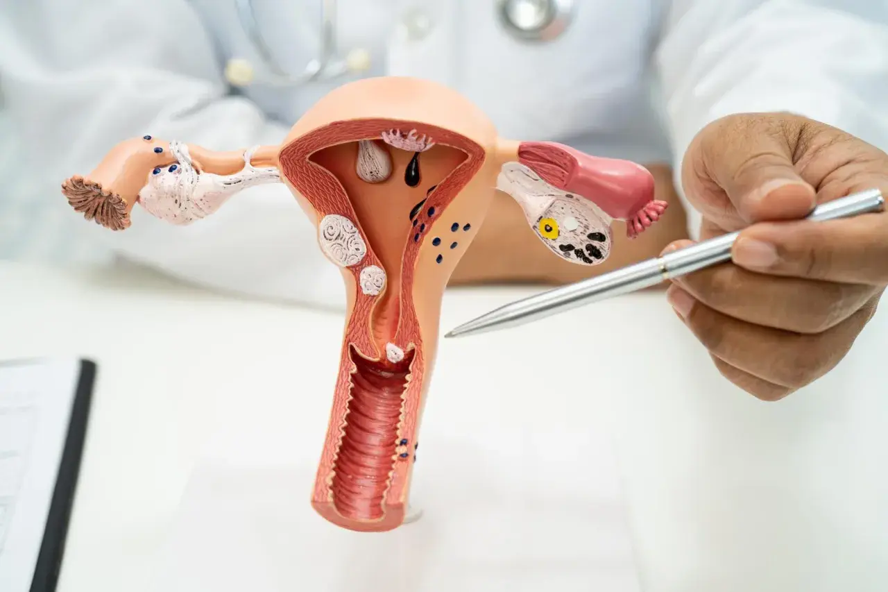 Model anatomiczny narządów rodnych kobiety, z zaznaczoną otwartą szyjką macicy w ciąży. Lekarz wskazuje na model.